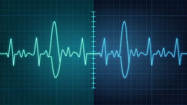 ECG with UPS interference